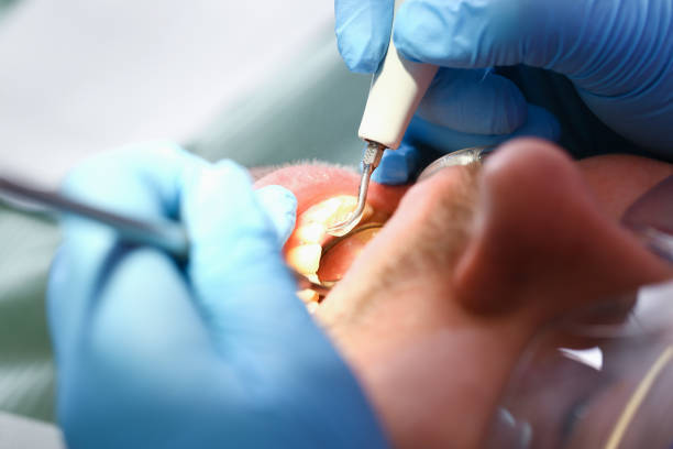 Best Cracked Tooth Emergency Dentist  in South Coatesville, PA