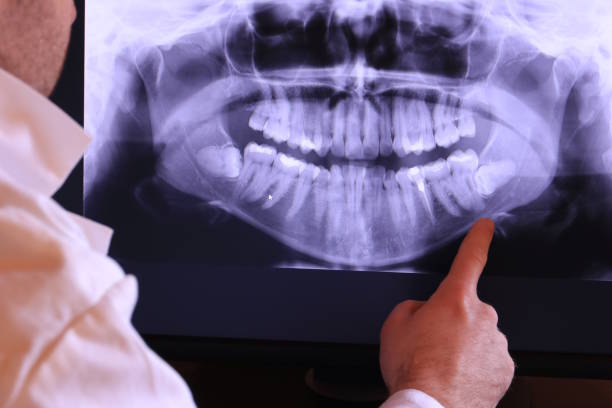 Best Chipped Tooth Repair Near Me  in South Coatesville, PA