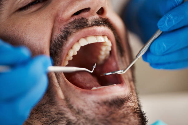 Best Dentist for Tooth Abscess  in South Coatesville, PA